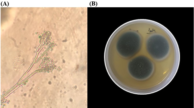 penicillium notatum under microscope