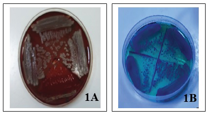 pseudomonas aeruginosa culture