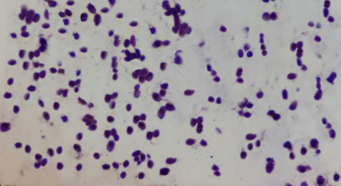 candida gram stain